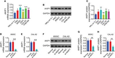 A-Kinase Interacting Protein 1 Knockdown Restores Chemosensitivity via Inactivating PI3K/AKT and β-Catenin Pathways in Anaplastic Thyroid Carcinoma